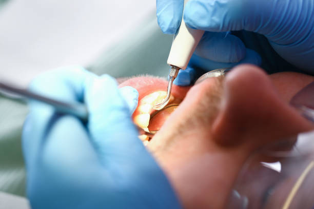 Best Root Canal Emergency Dentist  in Bloomington, TX